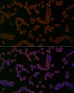 NALP1 Antibody in Immunocytochemistry (ICC/IF)