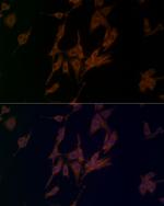 NALP1 Antibody in Immunocytochemistry (ICC/IF)