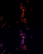 NALP1 Antibody in Immunocytochemistry (ICC/IF)
