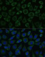 DDX6 Polyclonal Antibody