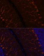 KAL1 Antibody in Immunohistochemistry (Paraffin) (IHC (P))