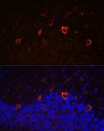 KAL1 Polyclonal Antibody