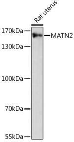 MATN2 Polyclonal Antibody