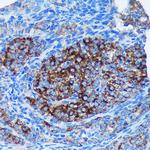 RM30 Antibody in Immunohistochemistry (Paraffin) (IHC (P))