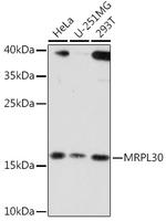 RM30 Antibody in Western Blot (WB)