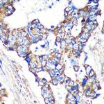 STARD3NL Antibody in Immunohistochemistry (Paraffin) (IHC (P))