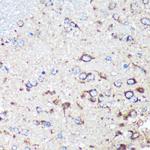 STARD3NL Antibody in Immunohistochemistry (Paraffin) (IHC (P))