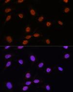 SRSF7 Polyclonal Antibody