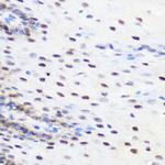 SRSF7 Antibody in Immunohistochemistry (Paraffin) (IHC (P))