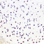 SRSF7 Antibody in Immunohistochemistry (Paraffin) (IHC (P))