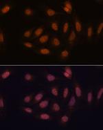 SNIP1 Polyclonal Antibody
