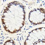 SNIP1 Antibody in Immunohistochemistry (Paraffin) (IHC (P))