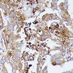 CD52 Antibody in Immunohistochemistry (Paraffin) (IHC (P))