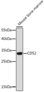 CD52 Antibody in Western Blot (WB)