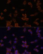 HMGCR Antibody in Immunocytochemistry (ICC/IF)