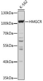 HMGCR Antibody in Western Blot (WB)