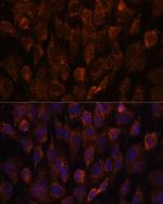 NSDHL Antibody in Immunocytochemistry (ICC/IF)