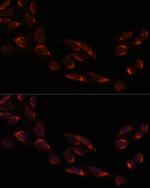 NSDHL Polyclonal Antibody