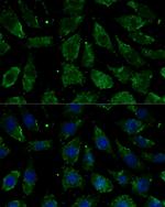 NDUFB1 Polyclonal Antibody