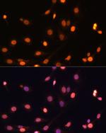 WT1 Antibody in Immunocytochemistry (ICC/IF)