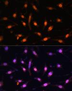 WT1 Antibody in Immunocytochemistry (ICC/IF)