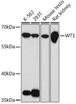WT1 Antibody in Western Blot (WB)