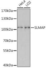 SLMAP Polyclonal Antibody