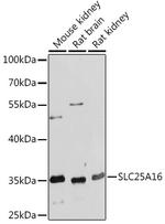 SLC25A16 Polyclonal Antibody