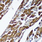 TMX2 Antibody in Immunohistochemistry (Paraffin) (IHC (P))