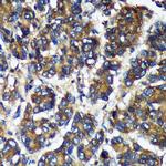 TMX2 Antibody in Immunohistochemistry (Paraffin) (IHC (P))