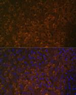 UGT1A6 Antibody in Immunohistochemistry (Paraffin) (IHC (P))