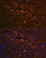 UGT1A6 Polyclonal Antibody