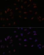 SMEK2 Antibody in Immunocytochemistry (ICC/IF)