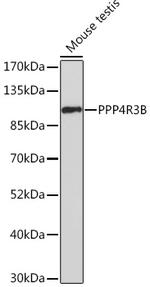 SMEK2 Antibody in Western Blot (WB)