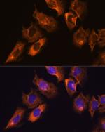 CaMKV Antibody in Immunocytochemistry (ICC/IF)