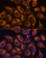 CaMKV Antibody in Immunocytochemistry (ICC/IF)