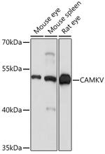 CaMKV Antibody in Western Blot (WB)