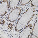 AKAP8 Polyclonal Antibody