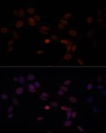 Lamin A/C Polyclonal Antibody