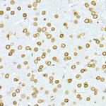 Lamin A/C Antibody in Immunohistochemistry (Paraffin) (IHC (P))
