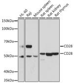 CD28 Antibody in Western Blot (WB)
