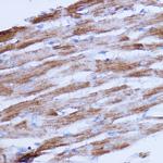 NDUFB9 Antibody in Immunohistochemistry (Paraffin) (IHC (P))