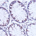 NDUFB9 Antibody in Immunohistochemistry (Paraffin) (IHC (P))
