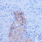 NDUFB9 Polyclonal Antibody