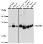 NDUFB9 Antibody in Western Blot (WB)