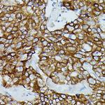 FCGR1B Polyclonal Antibody
