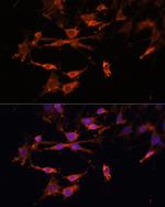 HLA-DPB1 Antibody in Immunocytochemistry (ICC/IF)