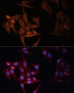 HLA-DPB1 Antibody in Immunocytochemistry (ICC/IF)