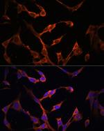 HLA-DPB1 Antibody in Immunocytochemistry (ICC/IF)