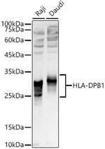 HLA-DPB1 Antibody in Western Blot (WB)